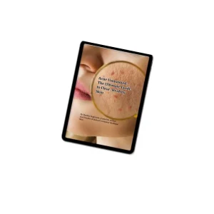 Acne Unmasked: The Clinical Guide to Clear Skin (45-Page), cover
