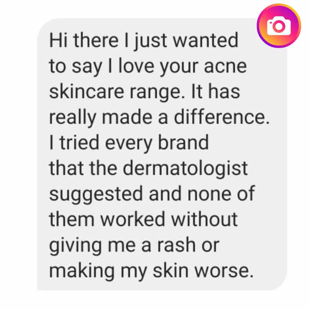 acne combo review before after 1