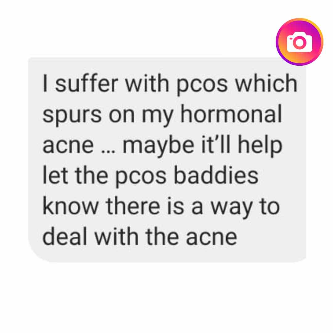 acne combo review before after 2