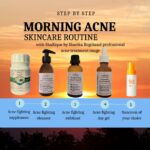acne website pics 29