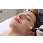 At-Home Microneedling Mistakes, How to Do It