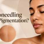 Does Microneedling Help Pigmentation? or does it worsen pigmentation.